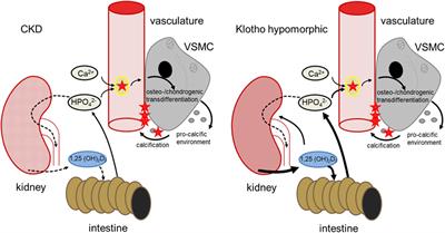 Therapeutic Interference With Vascular Calcification—Lessons From Klotho-Hypomorphic Mice and Beyond